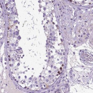 Anti-PLK5 antibody produced in rabbit 