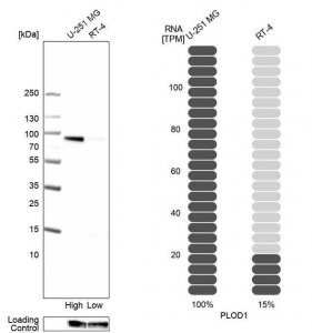 Anti-PLOD1 antibody produced in rabbit HPA049137-100UL