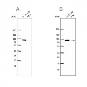 Anti-PLOD1 antibody produced in rabbit HPA049137-100UL