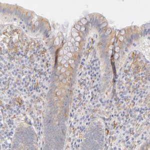 Anti-PLOD3 antibody produced in rabbit HPA001236-100UL