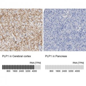 Anti-PLP1 antibody produced in rabbit 