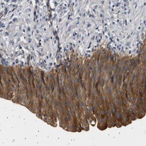 Anti-PLPP6 antibody produced in rabbit 