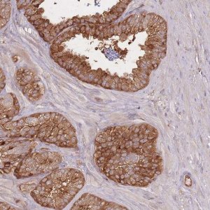 Anti-PLS3 antibody produced in rabbit 