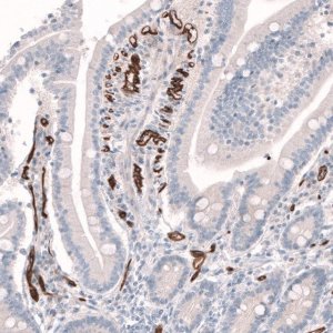 Anti-PLVAP antibody produced in rabbit 