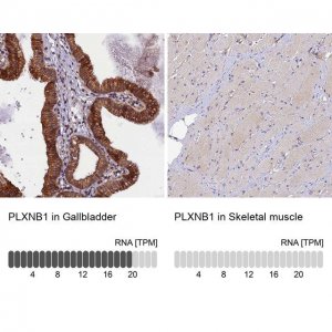 Anti-PLXNB1 antibody produced in rabbit 