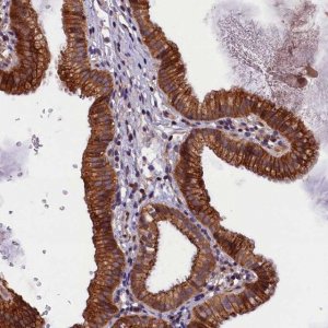 Anti-PLXNB1 antibody produced in rabbit 