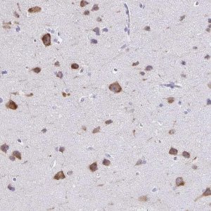 Anti-PLXNB3 antibody produced in rabbit 