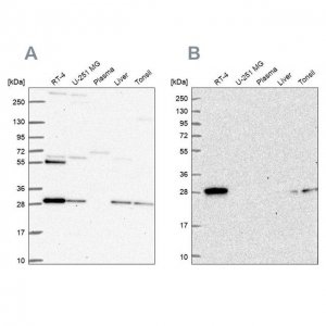 Anti-PMM2 antibody produced in rabbit 