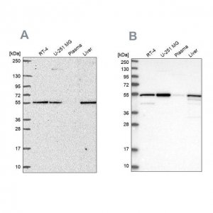 Anti-PMPCA antibody produced in rabbit 