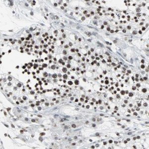 Anti-PNKP antibody produced in rabbit 