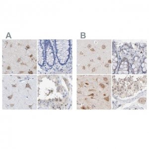 Anti-PNMA1 antibody produced in rabbit HPA015007-100UL