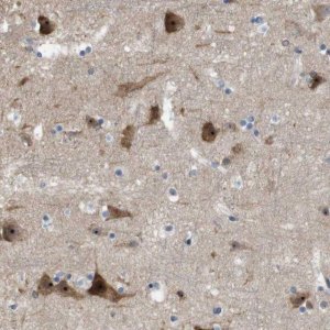 Anti-PNMAL1 antibody produced in rabbit 
