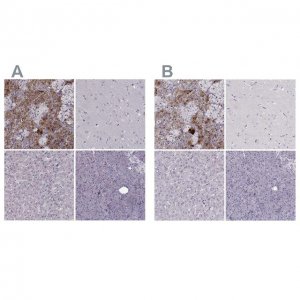 Anti-PNMT antibody produced in rabbit 