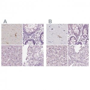 Anti-PNOC antibody produced in rabbit 