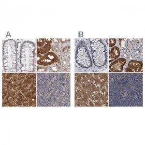 Anti-PNPO antibody produced in rabbit 