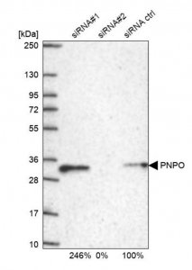 Anti-PNPO antibody produced in rabbit 
