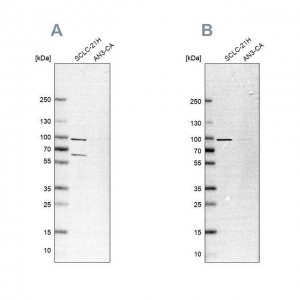 Anti-PNPT1 antibody produced in rabbit 
