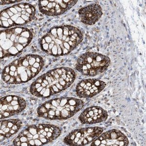Anti-PNPT1 antibody produced in rabbit 