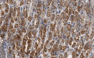 Anti-PNPT1 Antibody, clone 2D23 ZooMAb Rabbit Monoclonal 