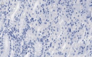 Anti-PNPT1 Antibody, clone 2D23 ZooMAb Rabbit Monoclonal 