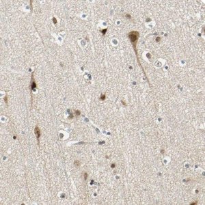 Anti-POGZ antibody produced in rabbit 