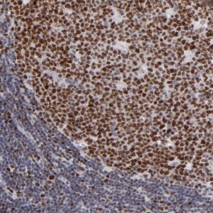 Anti-POLA1 antibody produced in rabbit 