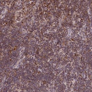 Anti-POLA2 antibody produced in rabbit 