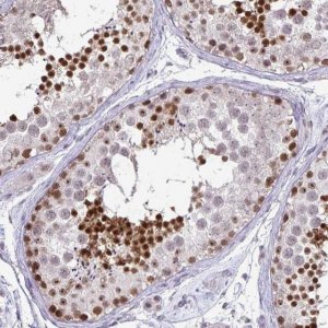 Anti-POLB antibody produced in rabbit 