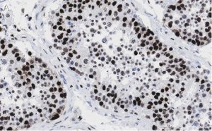 Anti-POLR2A Antibody, clone 3G21 ZooMAb Rabbit Monoclonal 