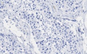 Anti-POLR2A Antibody, clone 3G21 ZooMAb Rabbit Monoclonal 