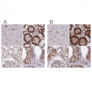 Anti-POLR2C antibody produced in rabbit HPA040919-100UL