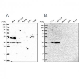 Anti-POLR2C antibody produced in rabbit HPA040919-100UL