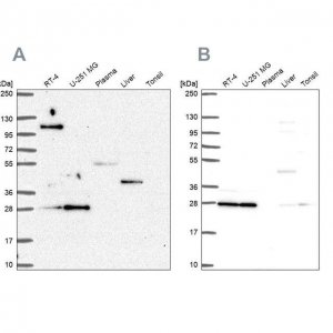 Anti-POLR2E antibody produced in rabbit 