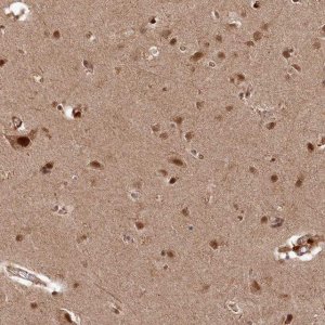 Anti-POLR3A antibody produced in rabbit 