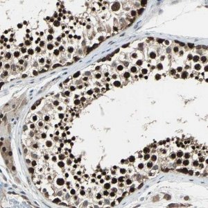 Anti-POLR3K antibody produced in rabbit HPA005891-100UL