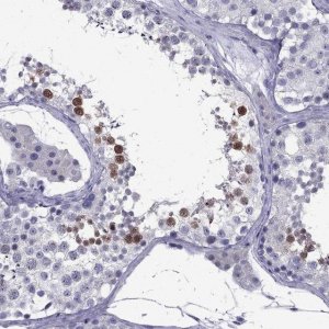 Anti-POM121L12 antibody produced in rabbit 