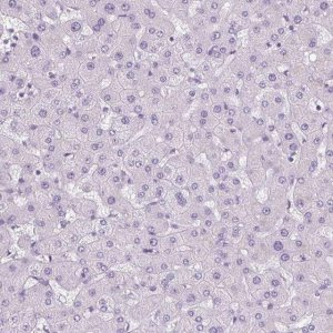 Anti-POPDC2 antibody produced in rabbit 