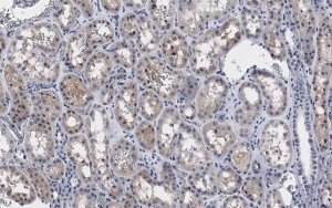 Anti-PP2A C subunit Antibody, clone 2B15 ZooMAb Rabbit Monoclonal 