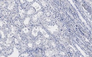 Anti-PP2A C subunit Antibody, clone 2B15 ZooMAb Rabbit Monoclonal 