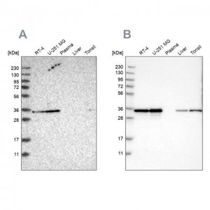 Anti-PPA1 antibody produced in rabbit HPA020096-100UL