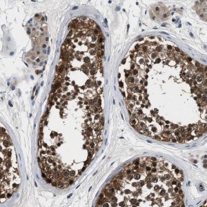 Anti-PPA1 antibody produced in rabbit HPA020096-100UL