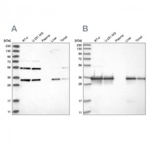 Anti-PPA2 antibody produced in rabbit 