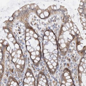 Anti-PPA2 antibody produced in rabbit 
