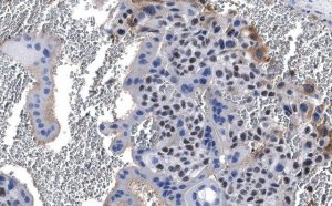 Anti-PPAR Antibody, clone 1I19 ZooMAb Rabbit Monoclonal 