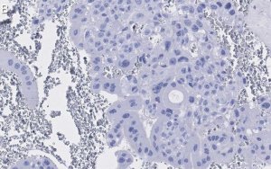 Anti-PPAR Antibody, clone 1I19 ZooMAb Rabbit Monoclonal 