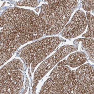 Anti-PPCS antibody produced in rabbit 