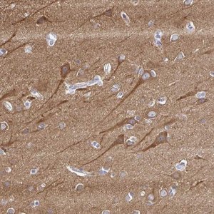 Anti-PPFIA4 antibody produced in rabbit 