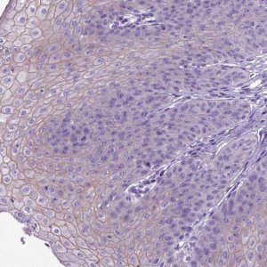 Anti-PPL antibody produced in rabbit 