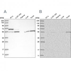 Anti-PPM1F antibody produced in rabbit 