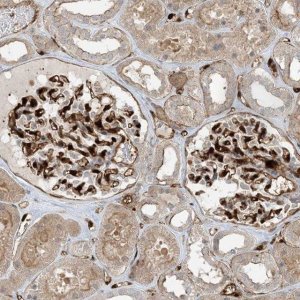 Anti-PPM1F antibody produced in rabbit 